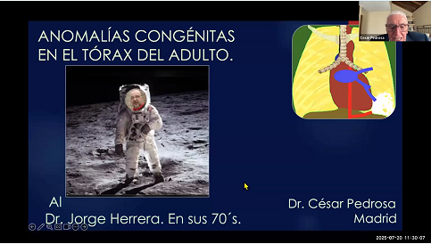 Conferencia